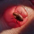 Jak wygląda ugryzienie karalucha